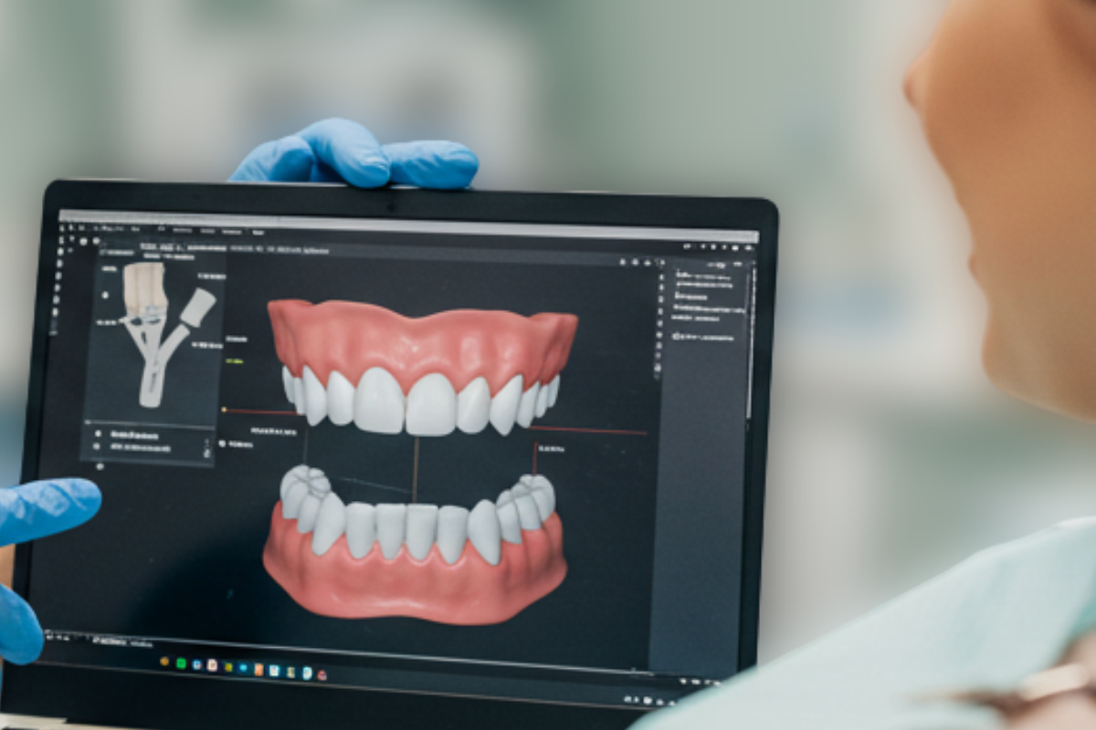 Visualización de un diseño de sonrisa digital en una pantalla, mostrando el resultado de un tratamiento de estética dental.