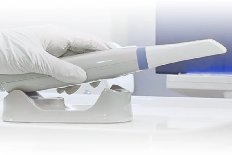 escaner-intraoral-3d-clinica-dental-dental-jardines-izcalli Escáner intraoral 3D de alta tecnología para diagnósticos precisos en Clínica Dental Jardines Izcalli.