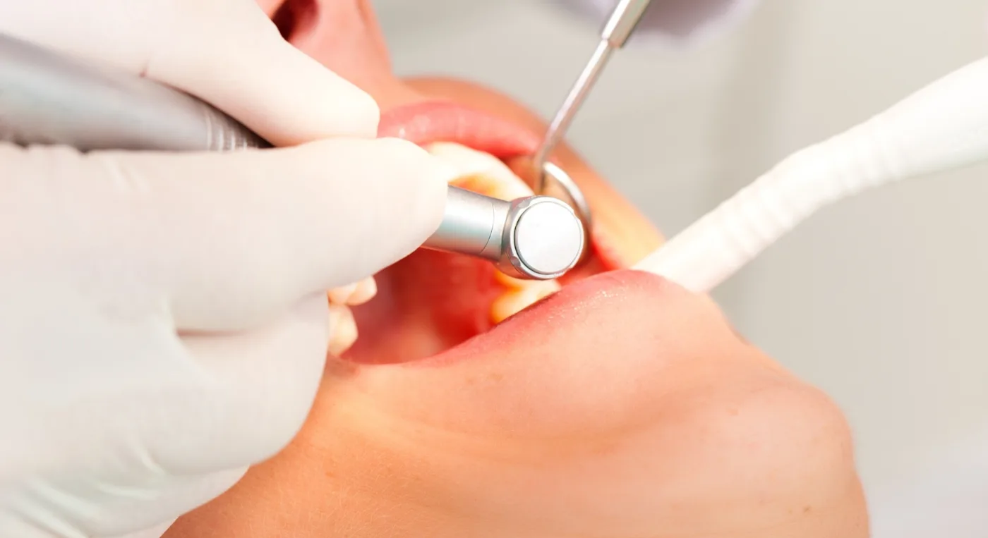 Paciente con una sonrisa saludable durante una limpieza dental profesional para el cuidado y prevención bucal.