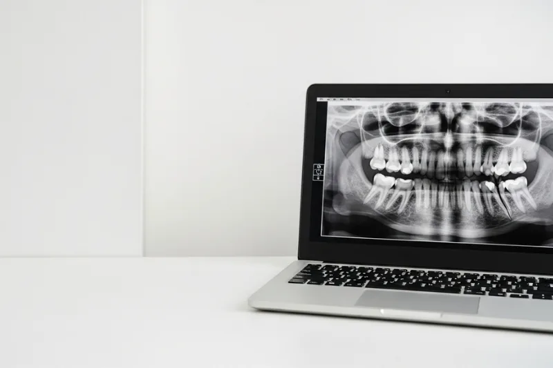 laptop muestra radiografía digital como apoyo para realizar un diagnóstico preciso en la primera visita dental