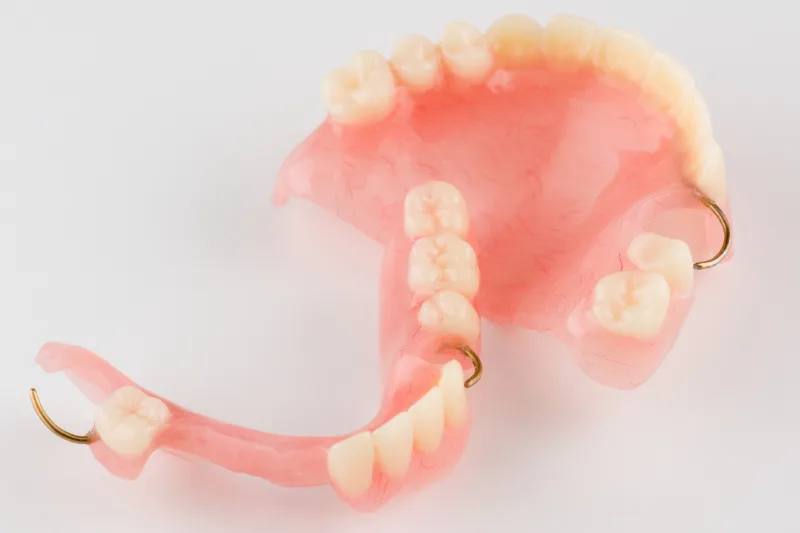 muestra de prótesis dental removible como solución de pérdida de dientes