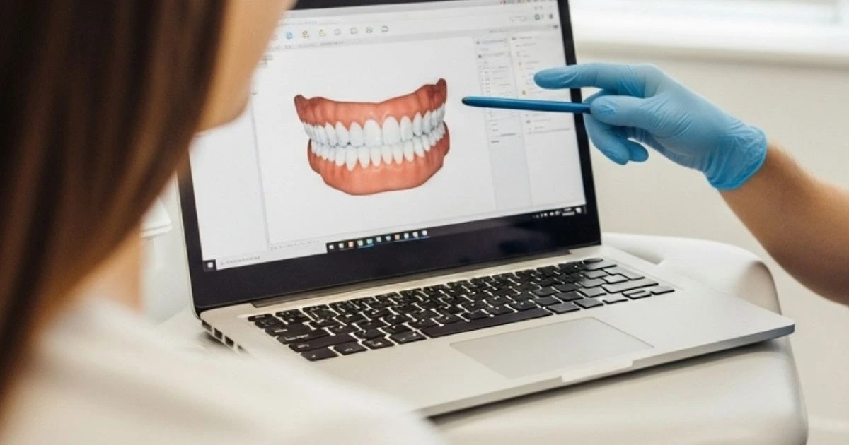 Mano de dentista explicando a paciente mujer como se realiza el diseño de sonrisa con el apoyo la pantalla que muestra el molde dental en 3D tomado con escaner intraoral